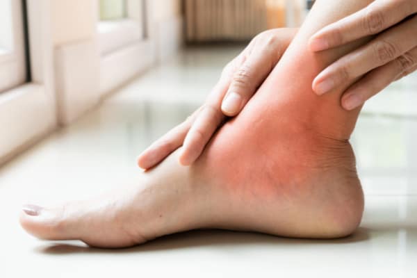 Ankle injury and proprioceptive balance rehabilitation guide by MMD Chiropractic Hamilton